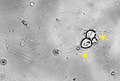 Parasitic Worms: Masters of Manipulation